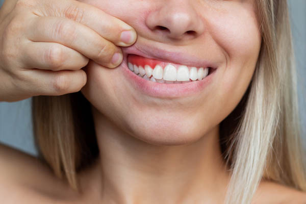 Ask a Periodontist - How Can Gum Disease Harm Your Teeth and Jawbone?