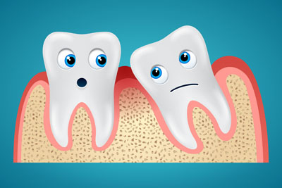 Periodontics